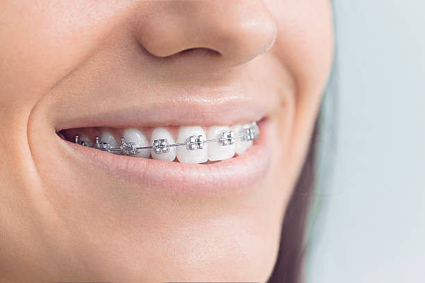 Best Teeth Whitening  in Ranchos De Taos, NM